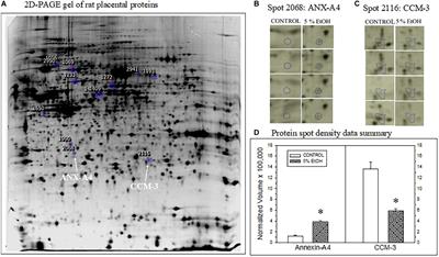 Ethanol-Induced Alterations in Placental and Fetal Cerebrocortical Annexin-A4 and Cerebral Cavernous Malformation Protein 3 Are Associated With Reductions in Fetal Cortical VEGF Receptor Binding and Microvascular Density